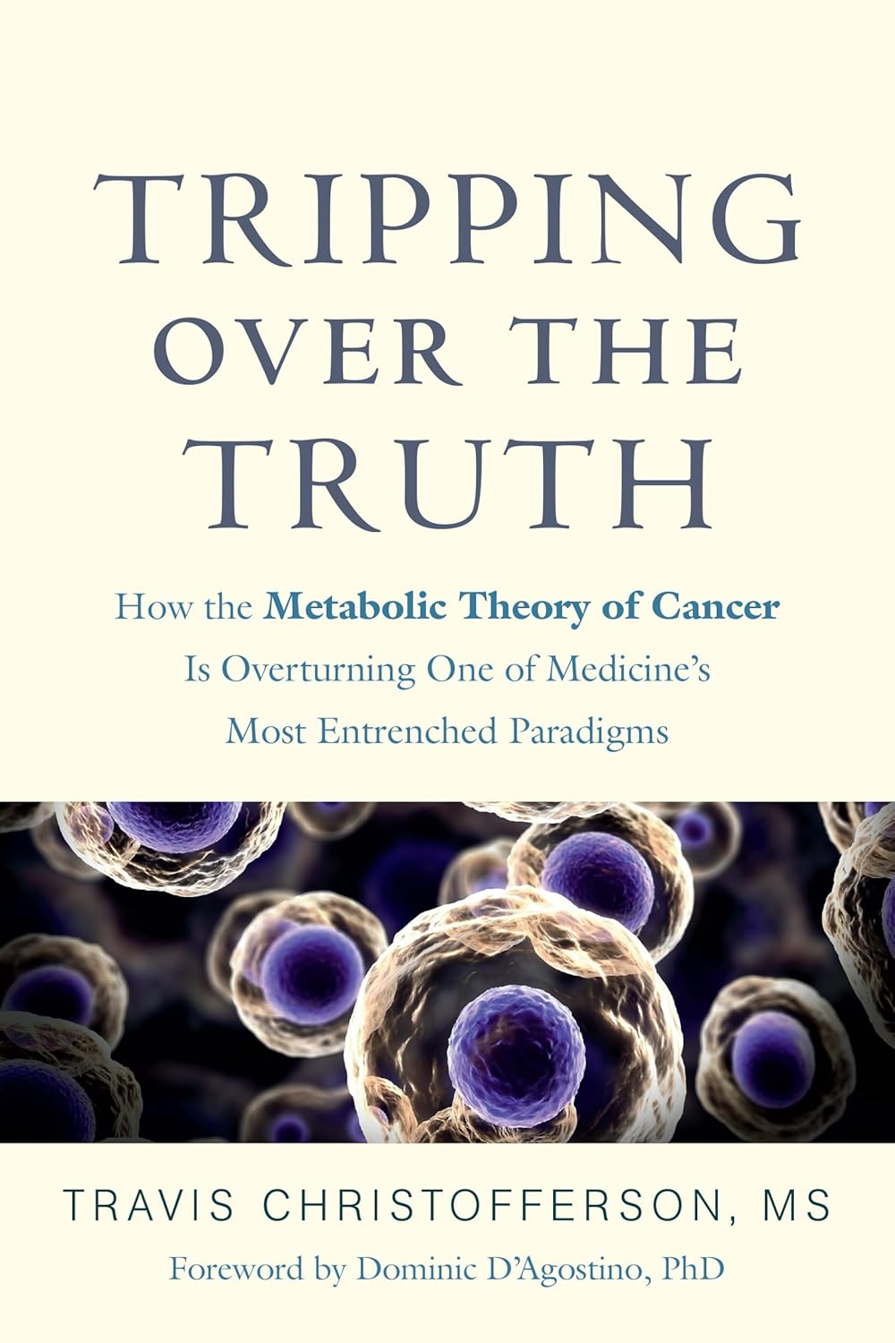 Tripping over the Truth How the Metabolic Theory of Cancer Is Overturning One of Medicine’s Most Entrenched Paradigms